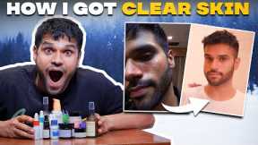 Winter Skincare Products MEN NEED 2022 | Winter Skin Care Routine | BeYourBest Grooming by San Kalra