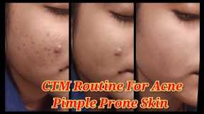 CTM Routine For Acne and Pimple Prone Skin | Oily Skin Care Routine |