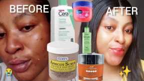 For an Even Tone skin ✨BEST SKIN CARE FOR PIMPLE AND DARK SPOTS FT*Cerave*Karis #skincare_routine