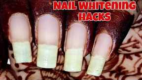 Grow & whiten your nails following these tips || Nail care & whitening hack by Nail Delights💅