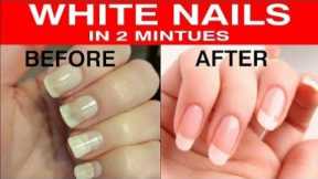 How To Whiten Nails At Home | My Nail Care | Nakhuno Ko Safed Krne Ka Sbse Aasan Or Achcha Tarika