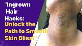 Ingrown Hair Treatment: Ultimate Guide to Smooth Skin