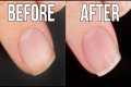 How I Saved My Cuticles (Nail Care