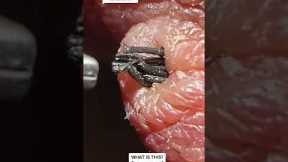 MasterCaca' - INSANE Ingrown Hair Extraction - Removed by Tweezer #fyp #hair #ingrownhairremoval