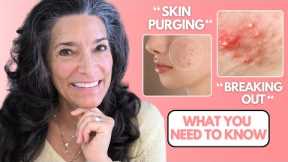Acne, Breakouts, Irritation, & Skin Purging | Why Your Skin is Changing from Your Products
