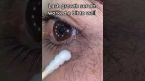 Lash growth serum Created by lisagobeauty