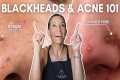 Blackhead Removal & Acne Care! |