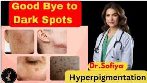 Dark Spots Kaise Hatayein: Ultimate Hyperpigmentation Treatment Guide| Best Tips & Secrets 2024#skin