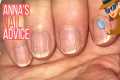 How To Care For Ridgy Nails  [ANNA'S