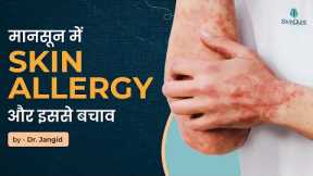 How to Treat Skin Allergies | Best Allergy Treatments for Sensitivity | Dr. Jangid | SkinQure