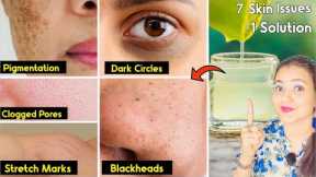 7 in 1 Skin Challenge : Skin Ki मुश्किल समस्या जैसे झाइयाँ PIGMENTATION, PORES का 100% इलाज़ सिर्फ💕