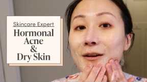 A Dermatologist’s Nighttime Skincare Routine for Hormonal Acne & Dry Skin | Skincare Expert