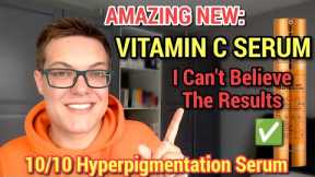 ULTIMATE HYPERPIGMENTATION SERUM - Next Level Korean Skincare Vitamin C